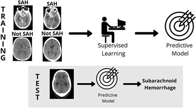 Machine Learning in Action: Stroke Diagnosis and Outcome Prediction